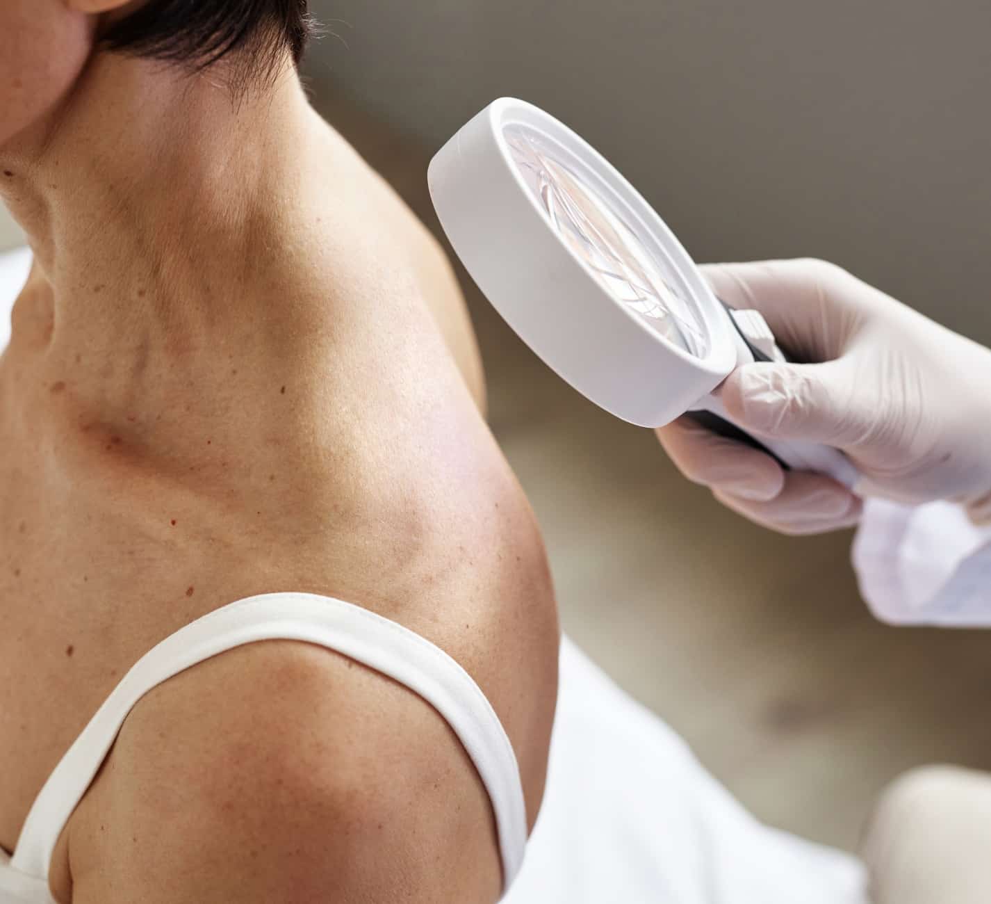 Vos besoins en dermatologie | Petite chirurgie dermatologique | Institut R.E.N | Gonesse